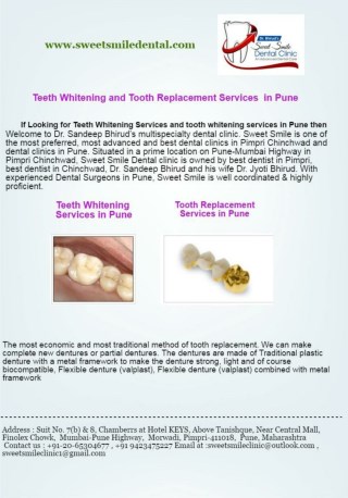 Teeth whitening In Pune, Teeth Whitening Cost In Pune - Sweet Smile Dental Clinic