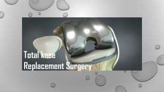 All you need to know Total knee Replacement
