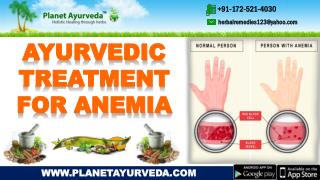 Ayurvedic Treatment for Anemia | Causes, Symptoms, Herbal Remedies & Diet
