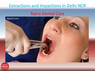 Extractions and Impactions in Delhi NCR