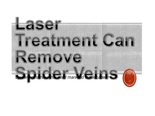 Laser Treatment Can Remove Spider Veins