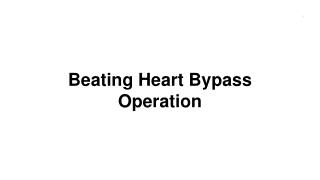 Beating Heart Bypass Surgery