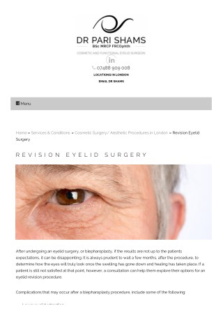 Revision Eyelid Surgery Harley Street | Eyelid Revision Procedure London
