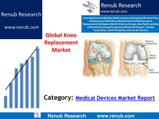 Knee Replacement Market