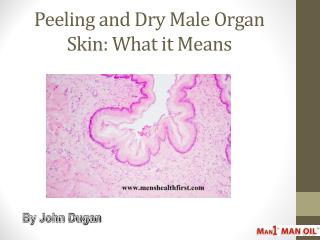 Peeling and Dry Male Organ Skin: What it Means