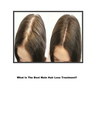 Alopecia Areata Hair Regrowth, Laser Hair Regrowth, Hair Regrowth Shampoo For Men