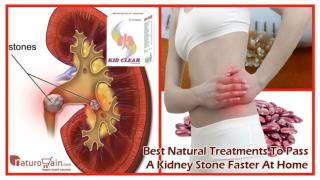 Best Natural Treatments to Pass a Kidney Stone Faster at Home