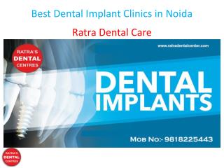 Best Dental Implant Clinics in Noida