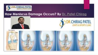 How Meniscus Damage Occurs? | Dr. Patel Chirag