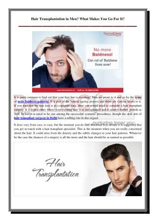 Hair Transplantation in Men? What Makes You Go For It?