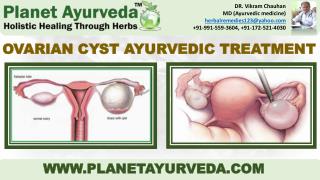 Ovarian Cyst - Types, Causes, Symptoms & Ayurvedic Treatment
