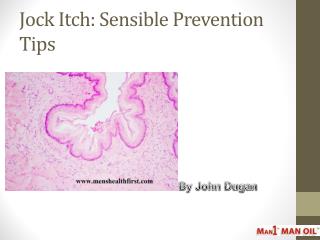 Jock Itch: Sensible Prevention Tips