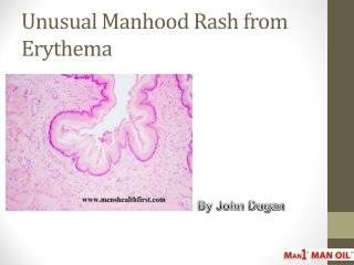 Unusual Manhood Rash from Erythema