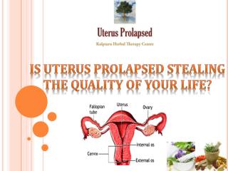Is Uterus Prolapsed Stealing the Quality of Your Life?