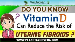 Do You Know That Vitamin D Can Reduce The Risk Of Uterine Fibroids?