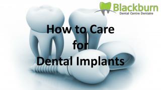 How to Care for Dental Implants