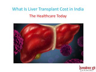 What Is Liver Transplant Cost in India