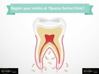 Regain your smiles at Tijuana Dental Clinic