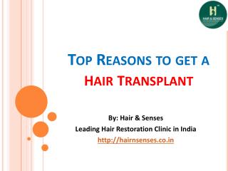 Top Reasons to Get a Hair Transplant