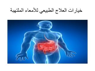Ø®ÙŠØ§Ø±Ø§Øª Ø§Ù„Ø¹Ù„Ø§Ø¬ Ø§Ù„Ø·Ø¨ÙŠØ¹ÙŠ Ù„Ù„Ø£Ù…Ø¹Ø§Ø¡ Ø§Ù„Ù…Ù„ØªÙ‡Ø¨Ø©
