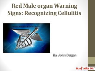 Red Male organ Warning Signs: Recognizing Cellulitis