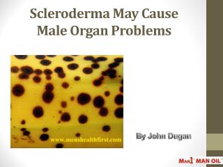 Scleroderma May Cause Male Organ Problems