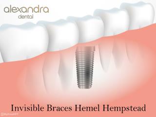 Invisible Braces Hemel Hempstead