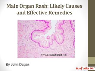 Male Organ Rash: Likely Causes and Effective Remedies