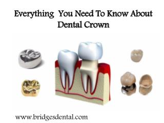 Valrico Dentist: Everything You Need To Know About Dental Crown