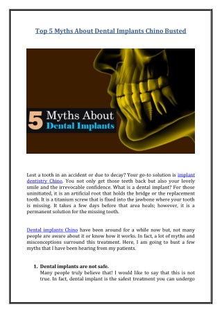 Top 5 Myths About Dental Implants Chino Busted