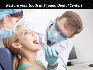 Restore your tooth at Tijuana Dental Center