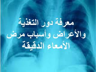 Ù…Ø¹Ø±ÙØ© Ø¯ÙˆØ± Ø§Ù„ØªØºØ°ÙŠØ© ÙˆØ§Ù„Ø£Ø¹Ø±Ø§Ø¶ ÙˆØ£Ø³Ø¨Ø§Ø¨ Ù…Ø±Ø¶ Ø§Ù„Ø£Ù…Ø¹Ø§Ø¡ Ø§Ù„Ø¯Ù‚ÙŠÙ‚Ø©