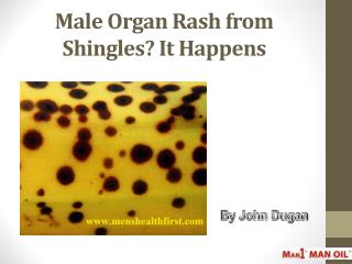 Male Organ Rash from Shingles? It Happens