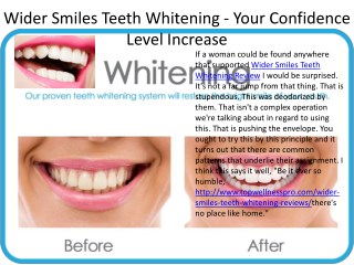 Wider Smiles Teeth Whitening - It'a Really Working