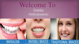 Are You Searching Invisalign Service in Dublin?