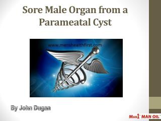 Sore Male Organ from a Parameatal Cyst