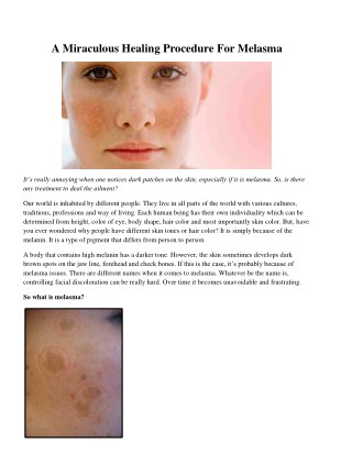 A Miraculous Healing Procedure For Melasma