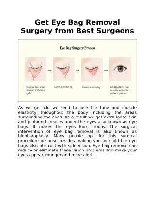 Get Eye Bag Removal Surgery From Best Surgeons