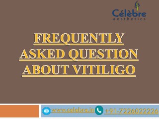 Frequently Asked Question about Vitiligo