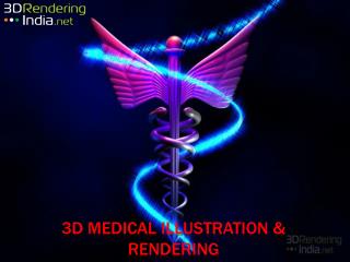 3D Medical Rendering | Medical Model Rendering