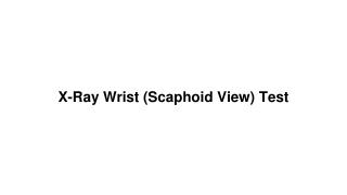 X ray wrist (scaphoid view) test