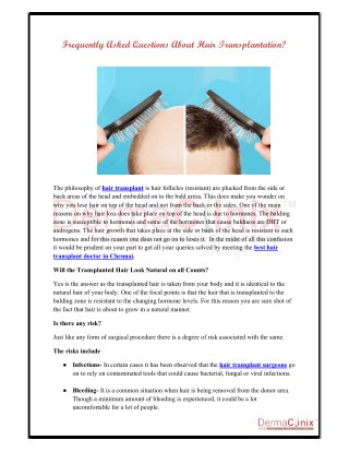 Frequently Asked Questions About Hair Transplantation?