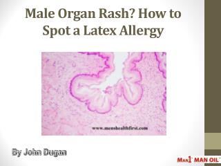 Male Organ Rash? How to Spot a Latex Allergy