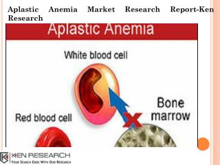 Aplastic Anemia Market Forecast-Ken Research