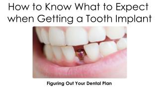 How to Know What to Expect when Getting a Tooth Implant
