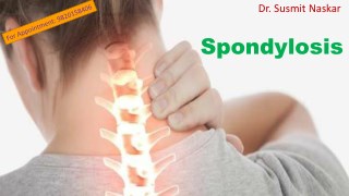 Spondilitis