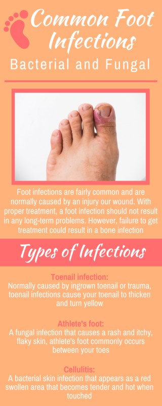 Common Foot Infections Bacterial and Fungal