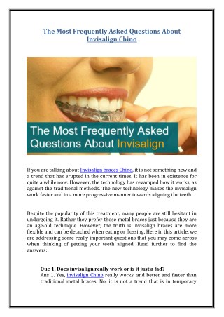 The Most Frequently Asked Questions about Invisalign Chino