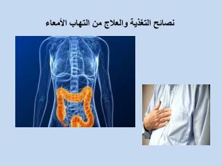 Ù†ØµØ§Ø¦Ø­ Ø§Ù„ØªØºØ°ÙŠØ© ÙˆØ§Ù„Ø¹Ù„Ø§Ø¬ Ù…Ù† Ø§Ù„ØªÙ‡Ø§Ø¨ Ø§Ù„Ø£Ù…Ø¹Ø§Ø¡