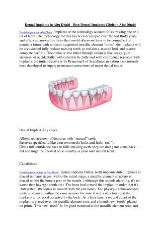 Dental implants in abu dhabi - Best dental implants clinic in abu dhabi